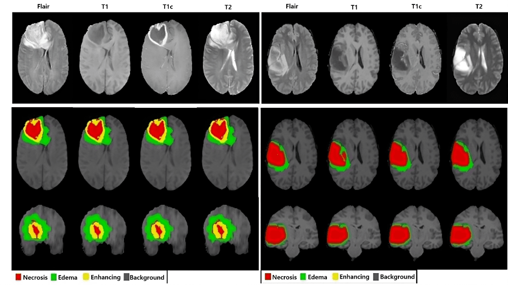 Brain Tumor Segmentation