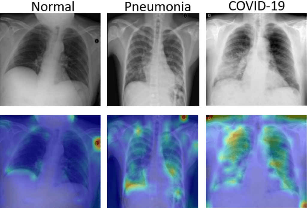 COVID-19 Detection CNN Ensemble
